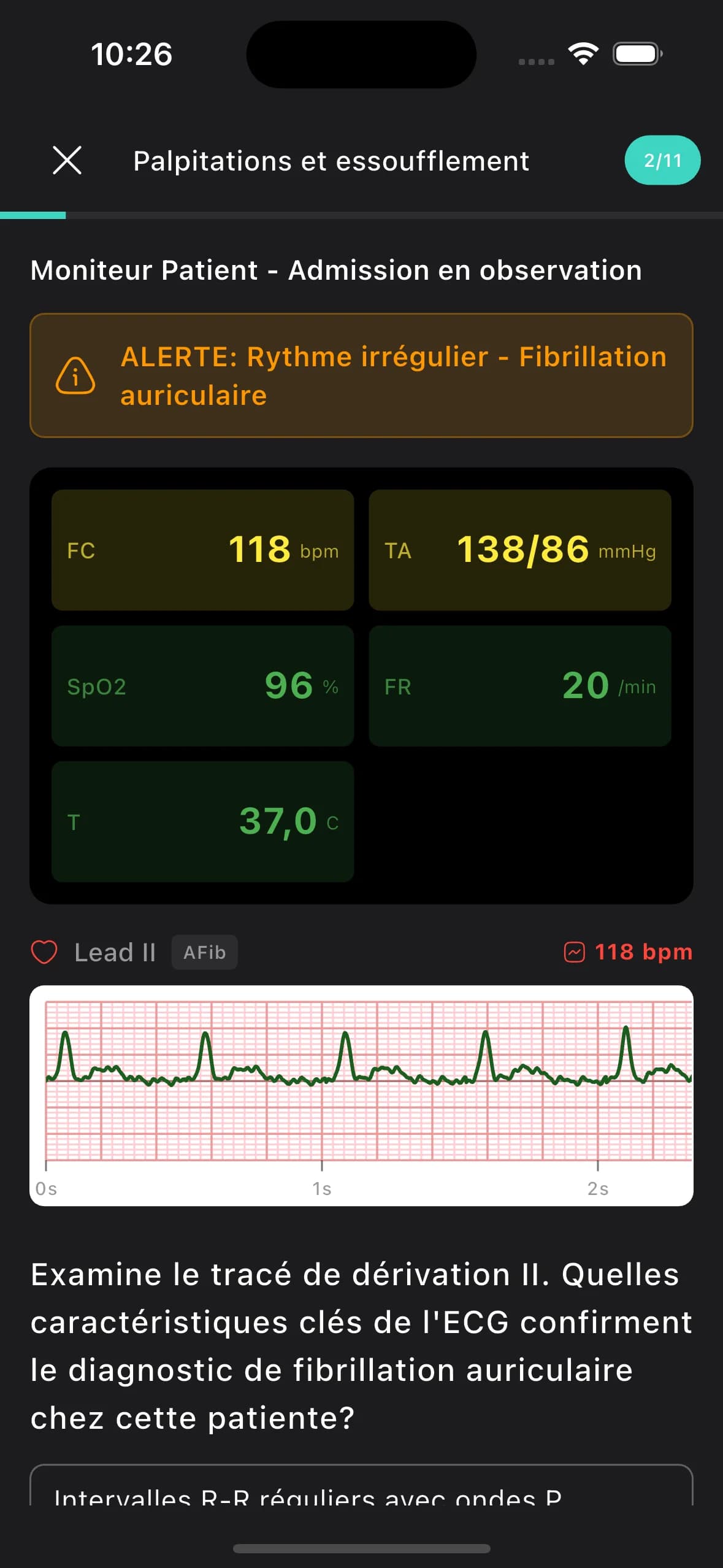 Micro-apprentissage de 5 minutes